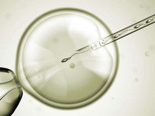 Künstliche Befruchtung - IVF/ICSI